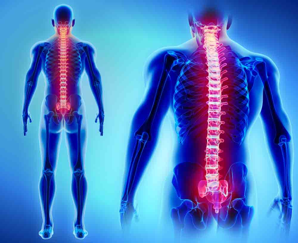 Here's what to expect from spinal cord injury rehabilitation spine back pain oakland physical therapy SOL 718049254 1 spinal cord injury rehabilitation, spinal cord injury rehabilitation near me, rehabilitation goals for spinal cord injury