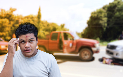 car accident face injuries